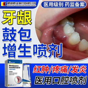 牙龈增生鼓包牙龈肿痛消炎息肉脓专用喷剂牙周炎漱口水药房同款YM