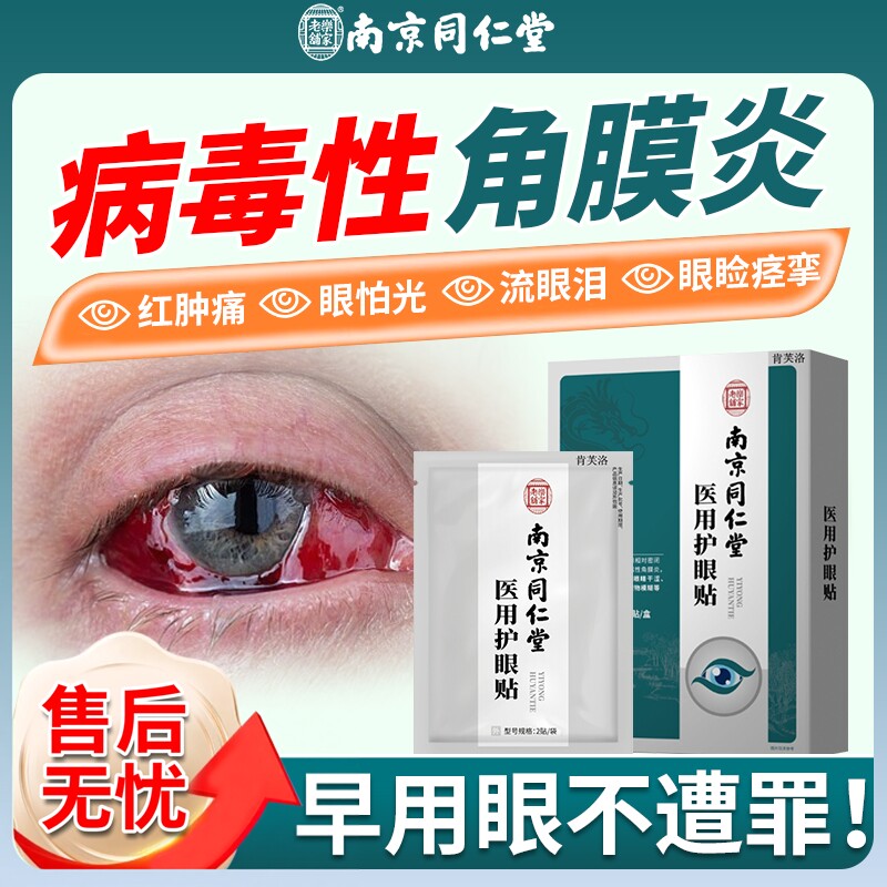 病毒性角膜炎眼贴结膜炎非滴眼液畏光流泪眼睛疼眼皮跳眼睑痉挛YS