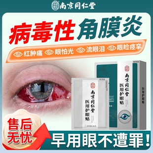 病毒性角膜炎眼贴结膜炎非滴眼液畏光流泪眼睛疼眼皮跳眼睑痉挛YS