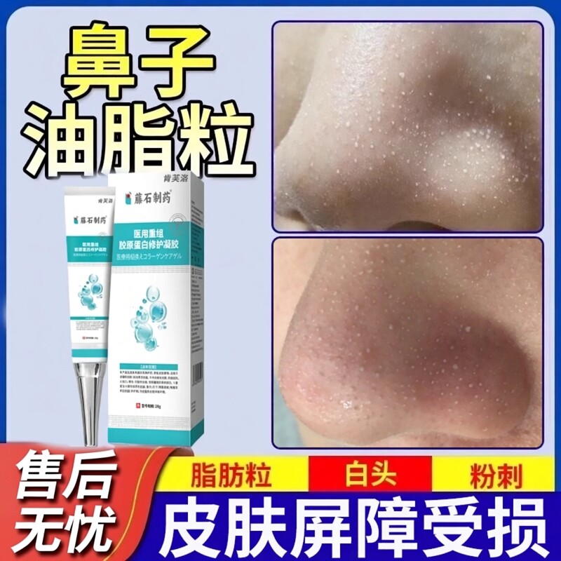 去鼻子油脂粒脂肪粒去除神器凝胶软膏鼻头可搭去除粟丘疹用YS
