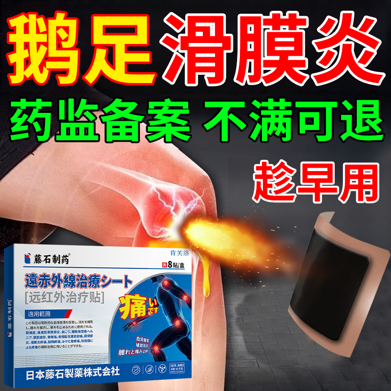 软组织损伤鹅足肌腱疼痛