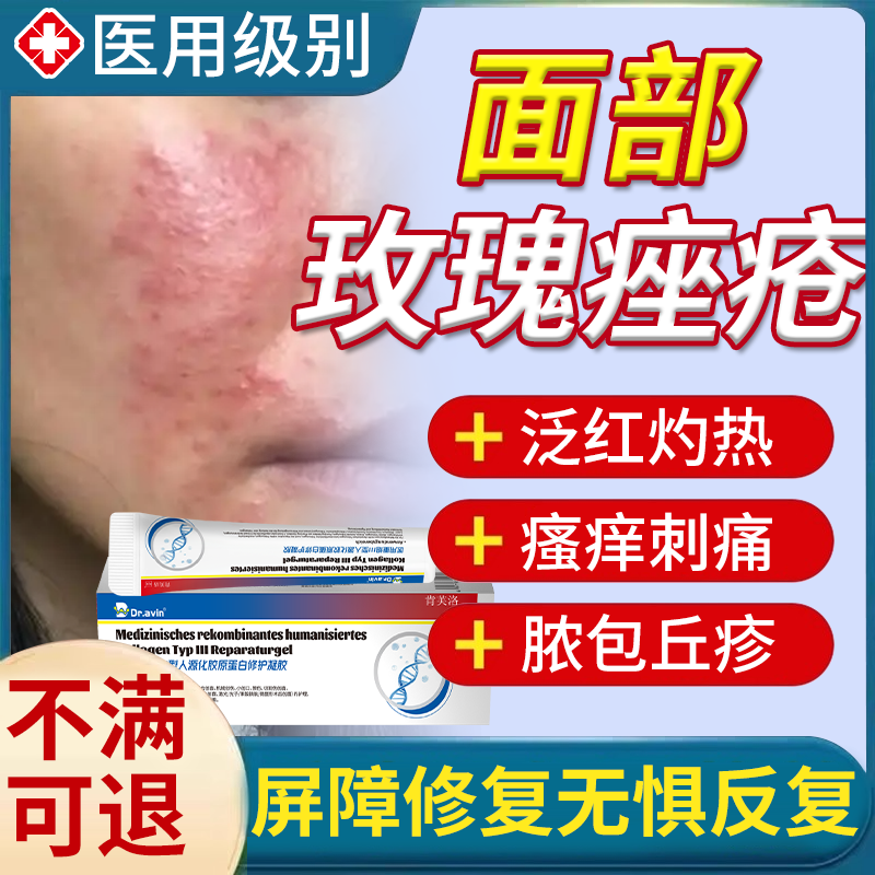 玫瑰痤疮屏障修复特软膏效药房膏非面霜酒糟鼻专用护肤品敏感肌YS,医疗器械,伤口敷料,淘宝优惠券,粉丝福利购,淘宝优惠卷