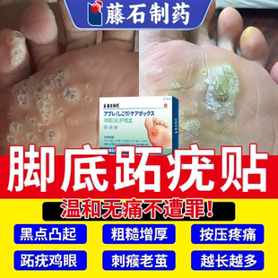 跖疣病毒疣连根拔去足部根脚底除专用去除药房膏非碘酊拓趾疣贴YS
