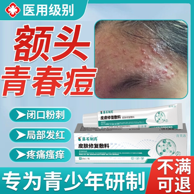 【现货速发】额头长痘痘