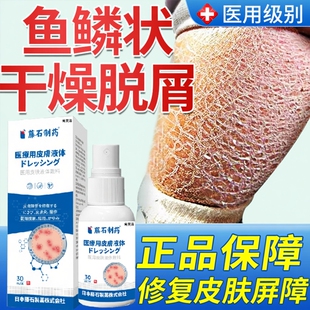 小腿皮肤干燥遗传性鱼鳞病蛇皮肤霜膏鱼鳞皮肤专用身体乳YM