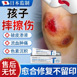 摔伤擦伤破皮药监备案儿童膏杀菌修复消炎结痂伤口快速愈合外伤YS