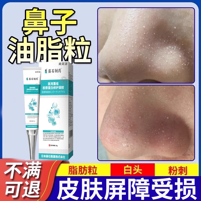 去鼻子油脂粒脂肪粒去除神器凝胶软膏鼻头可搭去除粟丘疹用YS,医疗器械,保健理疗,淘宝优惠券,粉丝福利购,淘宝优惠卷