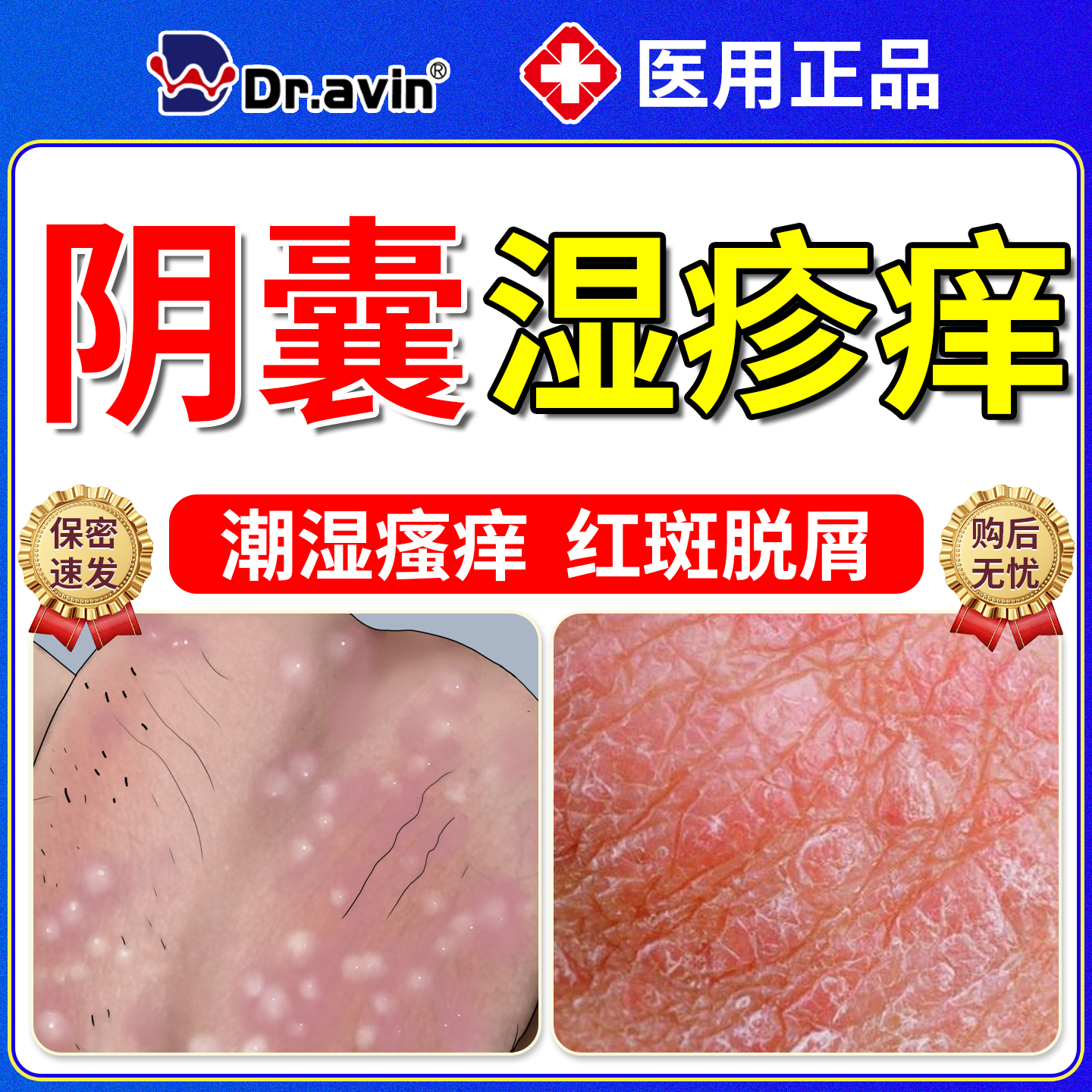 湿疹止痒癣瘙痒阴囊私处男潮湿非神器男人专用去睾丸出汗根男性YS