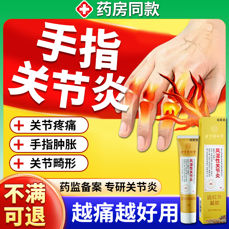 【手指关节炎】手指肿胀疼痛畸形