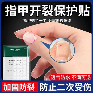 指甲盖受伤劈了防开裂指甲断裂保护贴保护套裂开修复加固防裂贴YS