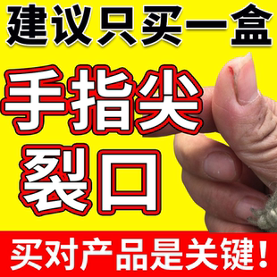 手指头裂口子手干裂霜手指尖开裂防裂愈合膏手足脱皮贴皲裂YS
