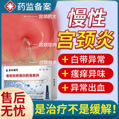 保密速发】慢性宫颈炎症反复发作