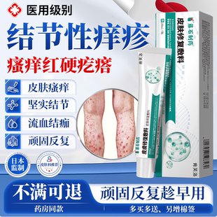 结节性痒疹皮肤湿疹治顽固红硬疙瘩皮肤瘙痒专用除湿止痒膏皮炎YY