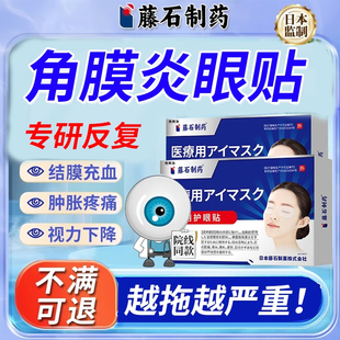 带状疱疹角膜炎滴眼液结膜充血畏光后遗症神经痛药房同款膏眼贴YM