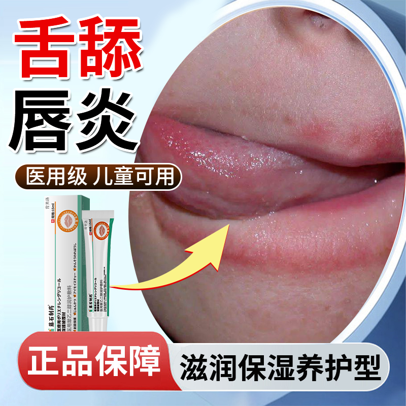 舌舔唇炎专用唇膏儿童嘴唇干裂脱皮医用型唇周红肿剥脱型润唇膏YM