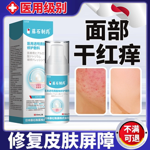 脸红敏感肌修复脸部泛红过敏皮肤屏障受损增厚角质层去除红血丝YS
