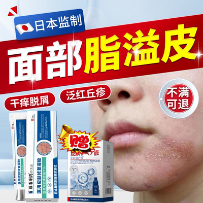 速发】鼻子脂皮两边泛红干燥起皮