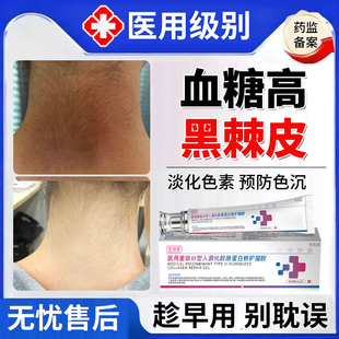 去脖子黑棘皮凝胶黑棘皮症黑色素沉淀淡化黑皮肤修复膏药房同款YM