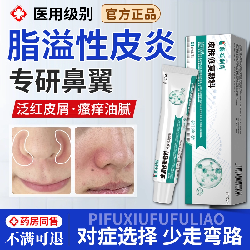 【鼻翼两侧泛红】脂溢性皮炎乳膏