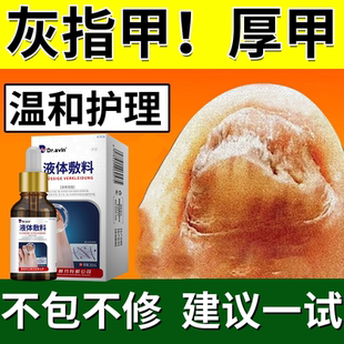 灰指甲真菌性白甲非冰醋酸30抗菌涂剂脚指甲变黄增厚药房同售水YS