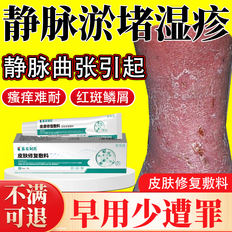 静脉曲张皮肤痒静脉炎老烂腿专用敷贴淤积性皮炎湿疹药房同款膏CF