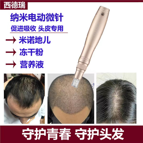 西德瑞电动头皮纳米微晶男女生用头发微针中胚层导入家用促吸收仪 - 封面