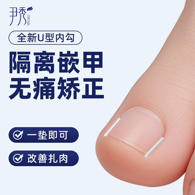 告别指甲长肉里甲沟炎嵌甲矫正器