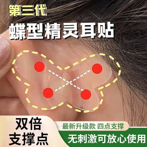 蝴蝶型隐形耳贴强支撑显脸小神器