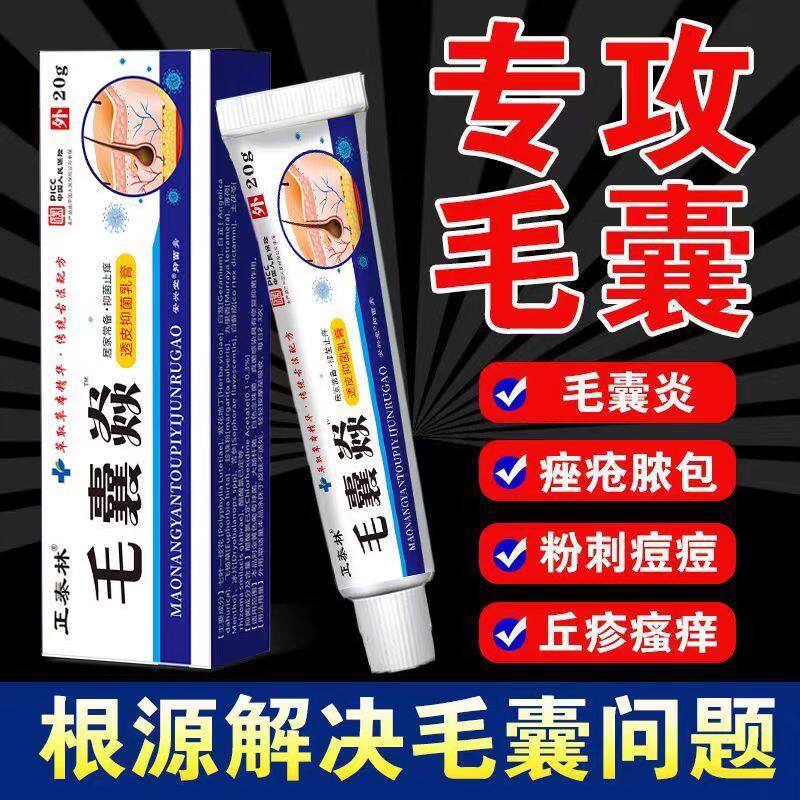 头上长痘痘毛囊炎脓包疙瘩脓疮毛囊发炎堵塞抑菌止痒草本温和乳膏