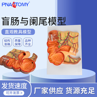 厂家供应人体医学回盲部解剖模型盲肠阑尾升结回肠血管阑尾模型