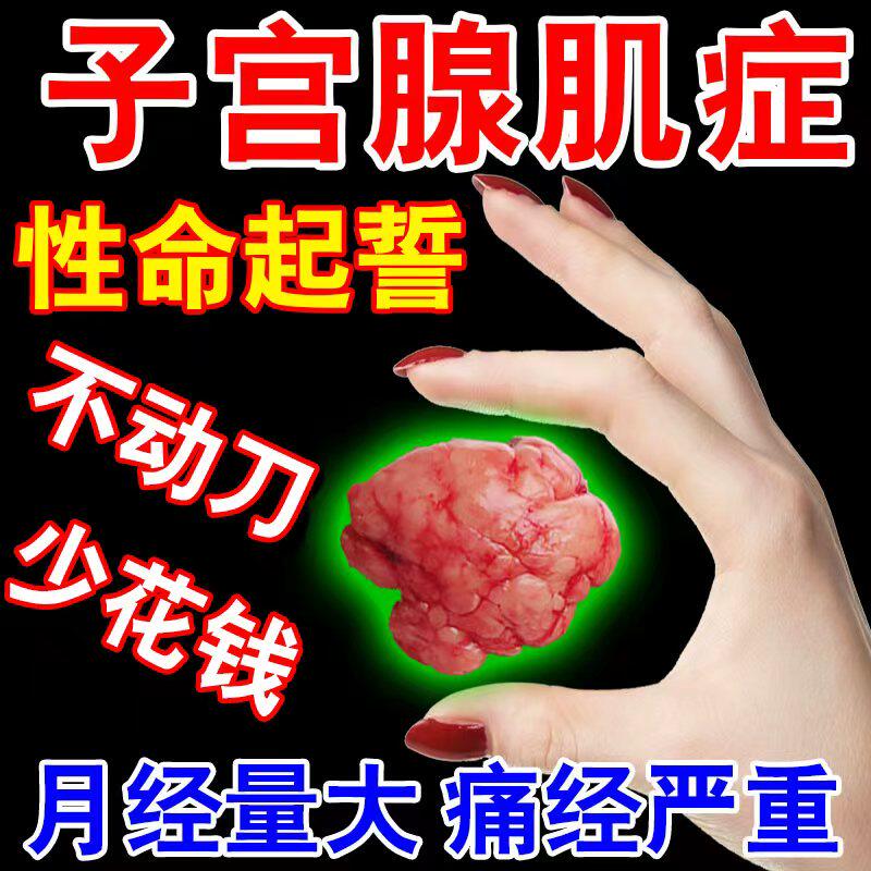 子宫腺肌症专用子宫肌瘤内膜异位调理宫寒痛经加重月经不调专用贴
