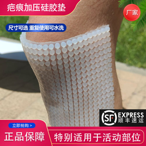 圆柱3D疤痕加压垫术后烧烫伤加压