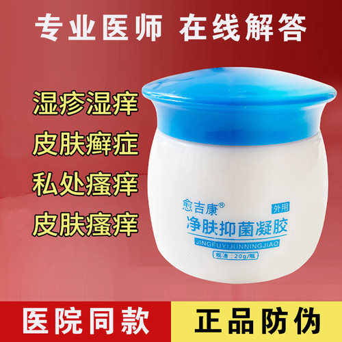 股藓湿疹止痒大腿内侧真菌