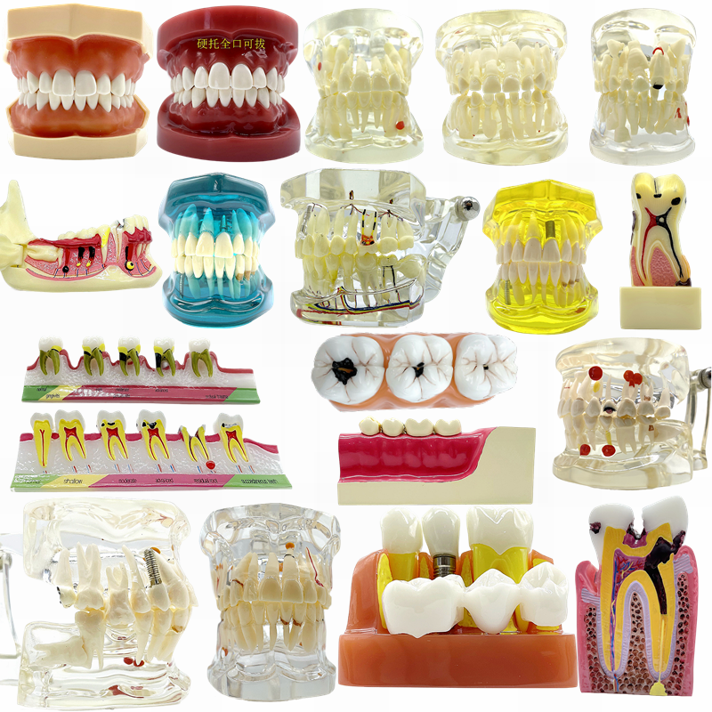 牙科牙齿模型口腔教学模型正畸种植修复备牙练习模型医患沟通模型