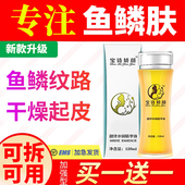 宝诗娇颜去蛇皮鱼鳞皮肤小腿部秋冬干性肤质滋润全身保湿 身体乳霜