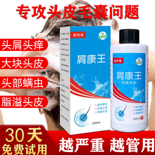 屑康王去屑止痒洗发水去严重头屑头痒除螨虫控油大块头皮屑洗发露