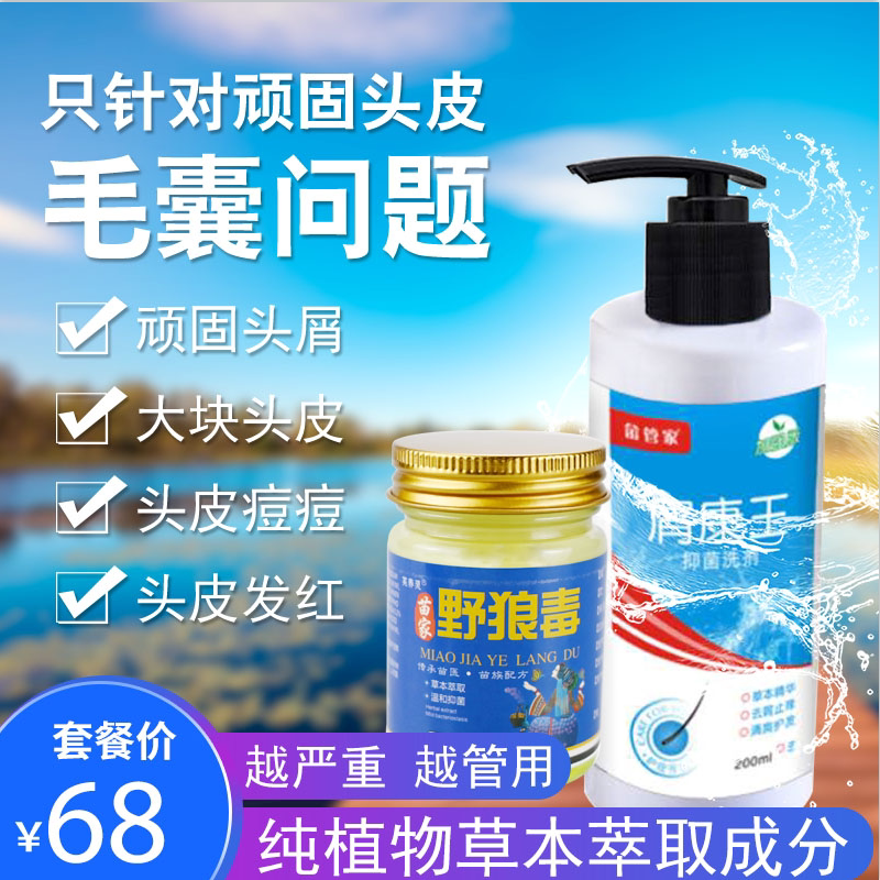 去屑止痒洗发水去严重头屑头痒除洗发水