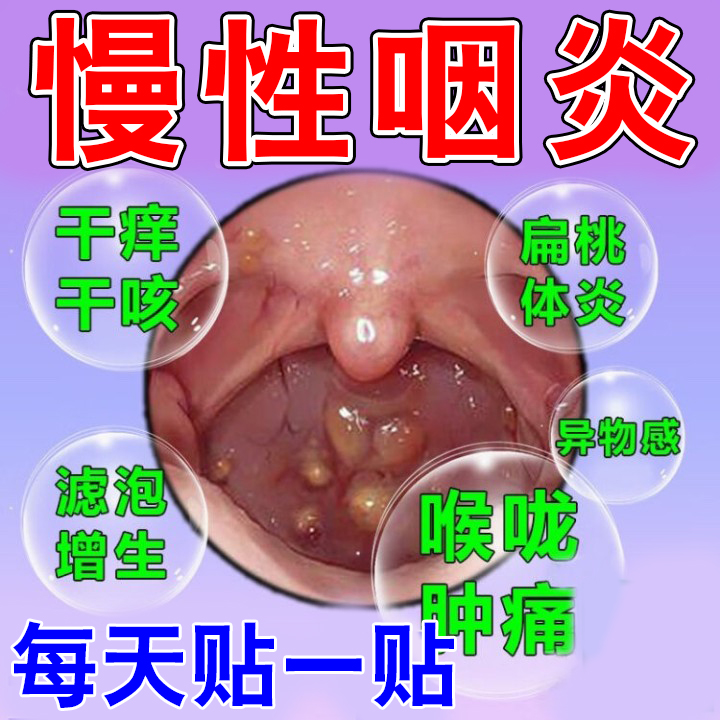 咽炎贴咽喉炎慢性咽炎贴除喉咙有痰异...