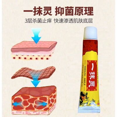 顽达康一抹灵抑菌乳膏宇一抹灵宇g草本软膏