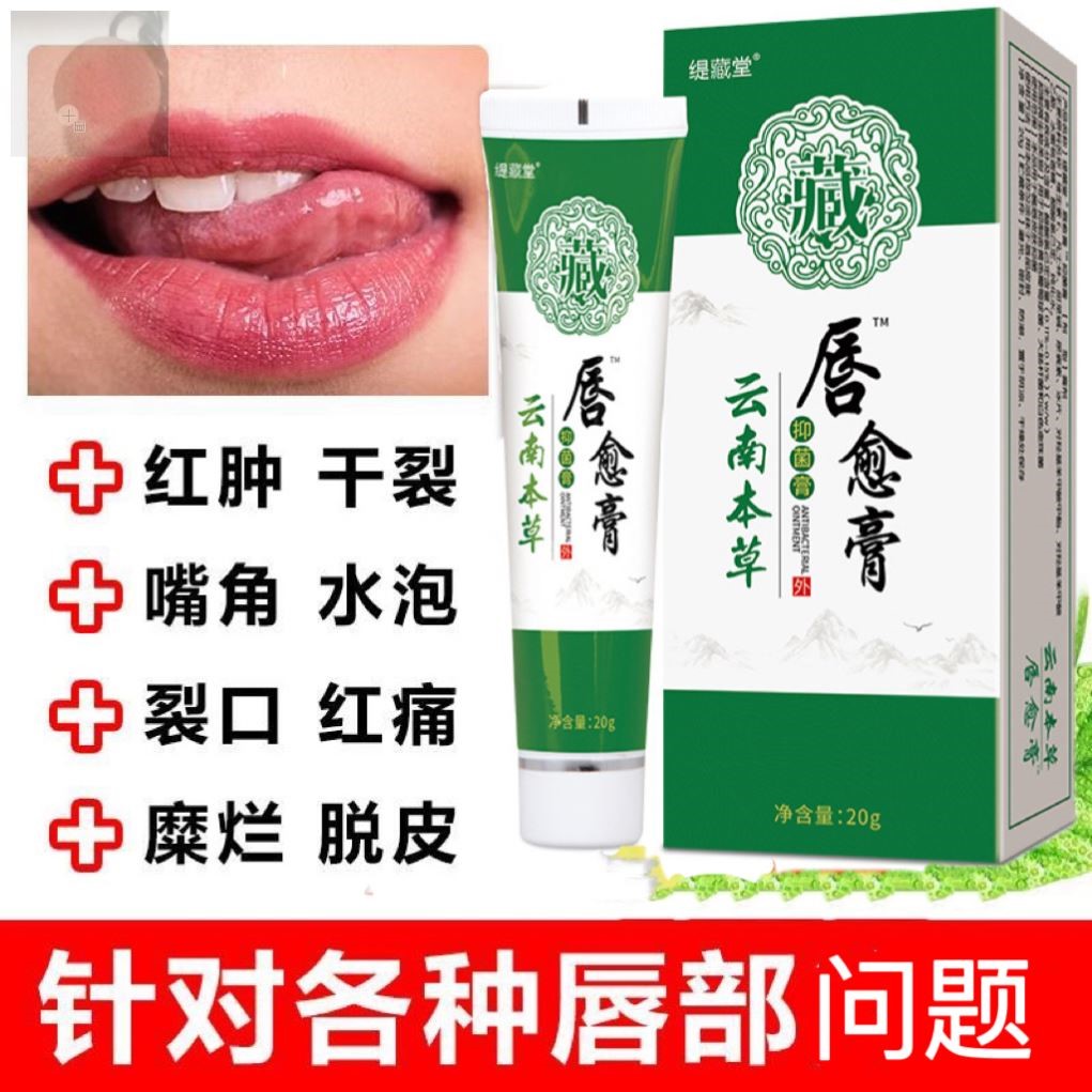 云南本草唇炎润唇膏专用药修复嘴唇干裂起泡脱皮嘴角裂保湿滋润女