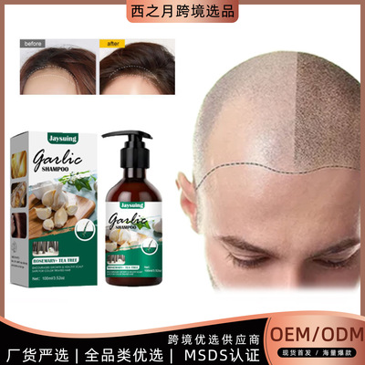 Jaysuing大蒜洗发水头发止痒去头屑洗发水头发滋养生长防掉洗发水