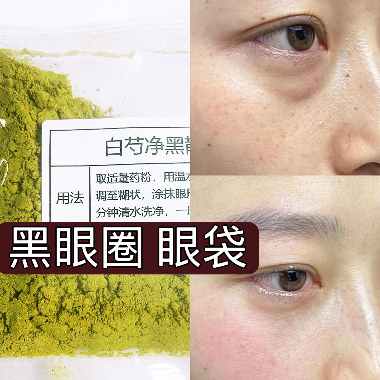 【市一院】【白芍净黑散】眼袋 黑眼圈 眼部细纹 涂抹面膜