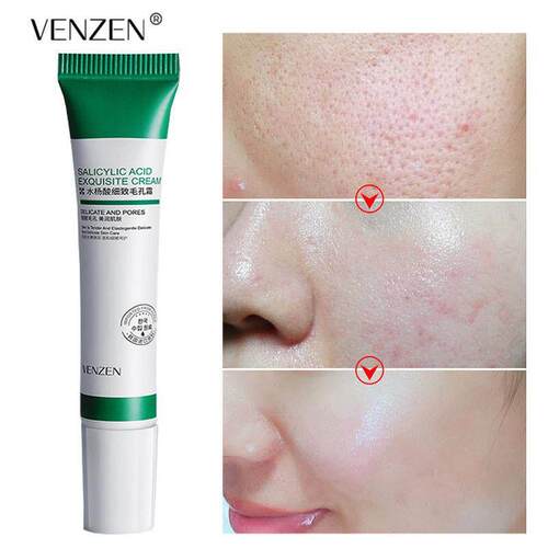 20ml Salicylic Acid Pores Refining Cream Shrink Pore Improve