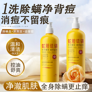 蛇胆硫磺沐浴露祛痘除螨后背瘙痒去螨虫皂液皮肤止痒通用持久留香