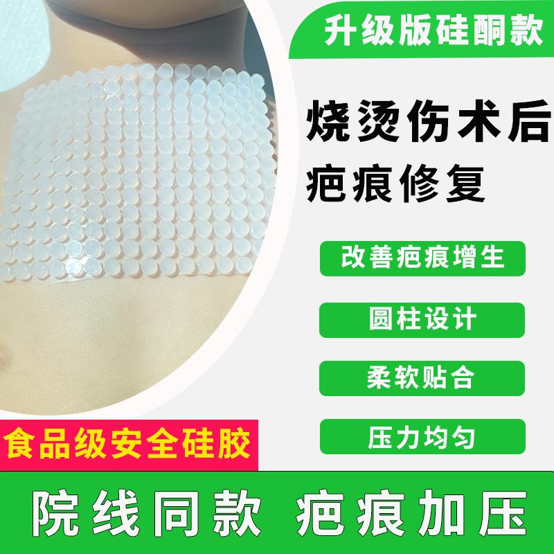 硅酮疤痕增压垫透气儿童增生