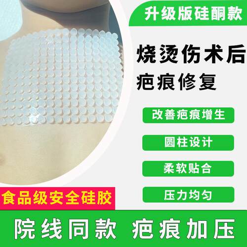 硅酮疤痕增压垫透气儿童增生
