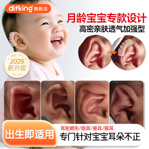 【出生即用】宝宝耳朵定型矫正器