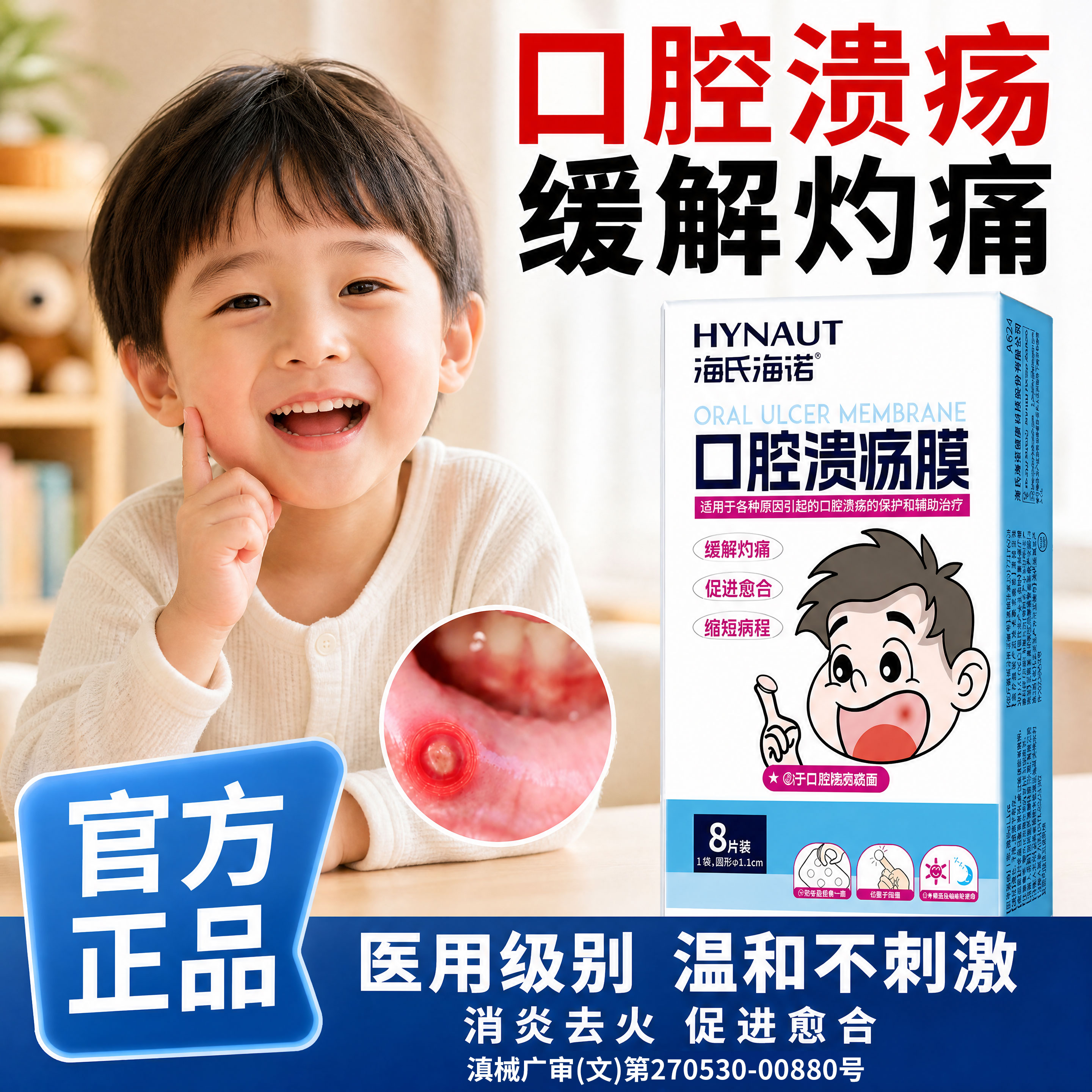 海氏海诺口腔溃疡膜舌头起泡口疮贴片凝胶上火舒缓成人儿童专用