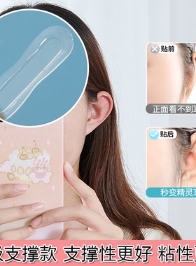 全新升级龙骨固定隐形神器精灵耳贴强支撑防无痕硅胶耳贴脸大显小