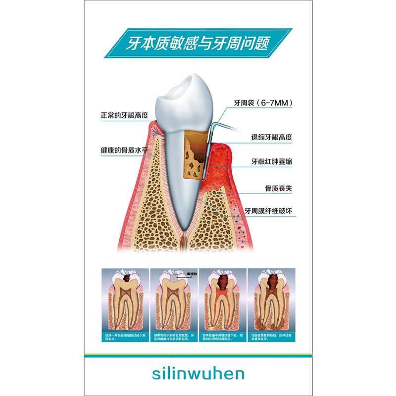 牙齿结构图牙齿疾病构造成人牙列知识口腔保健医院装饰画海报贴画